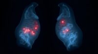 ai enhances breast cancer prediction