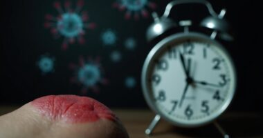 mpox symptoms delayed onset