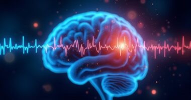 seizures reinforced by sleep