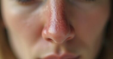 nasal cycle affects airflow